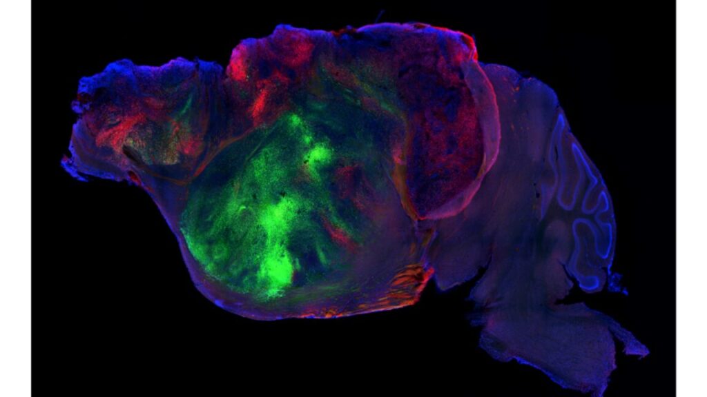 Researchers Swap Human Brain Cells with Mouse Cortex Researchers Swap Human Brain Cells with Mouse Cortex