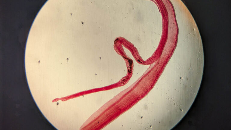 Tests confirm brain parasitic infection in woman with eggs growing tails Tests confirm brain parasitic infection in woman with eggs growing