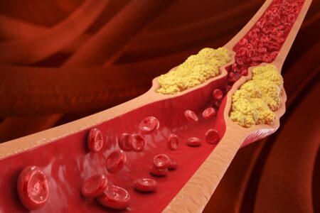 The Top Method Recommended by Doctors to Lower Cholesterol Naturally