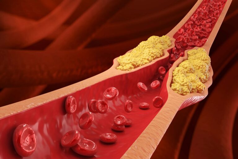 The Top Method Recommended by Doctors to Lower Cholesterol Naturally Without Statins The Top Method Recommended by Doctors to Lower Cholesterol Naturally
