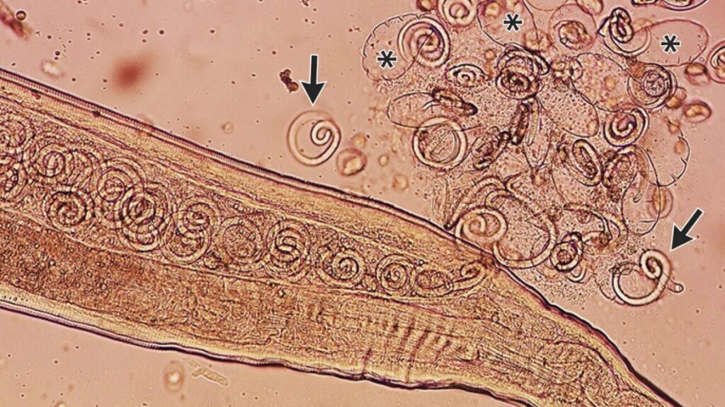 Insects Mate Inside a Human Eye as Larvae Are Removed Before They Emerge Insects Mate Inside a Human Eye as Larvae Are Removed