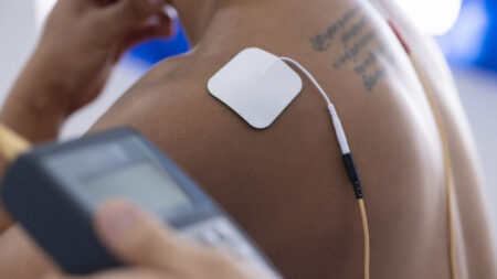 Local network of implants utilizes body as wiring