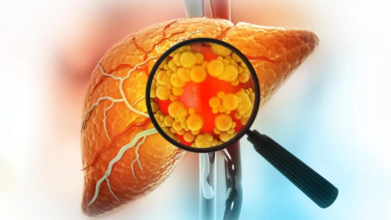 Scientists Discover Fatty Liver Disease is Actually Five Different Conditions Scientists Discover Fatty Liver Disease is Actually Five Different Conditions