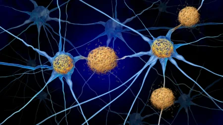 Scientists discover method to combat Alzheimer’s brain damage without removing toxic tau Scientists may have overlooked a hidden cause of Alzheimers disease