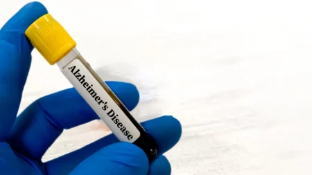 Simple Blood Test May Detect Alzheimer’s Disease Risk 10 Years Before Symptoms Appear Simple Blood Test May Detect Alzheimers Disease Risk 10 Years