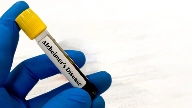 Simple Blood Test May Detect Alzheimers Disease Risk 10 Years